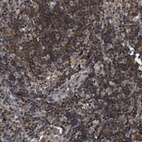 Immunohistochemical staining of human lymph node shows high expression.