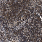 Immunohistochemical staining of human lymph node shows high expression.