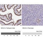 Anti-BCL9 Antibody