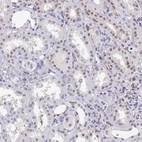 Immunohistochemical staining of human kidney shows weak nuclear positivity in cells in tubules.
