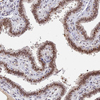 Immunohistochemical staining of human fallopian tube shows strong nuclear positivity in glandular cells.