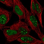 Immunofluorescent staining of human cell line SH-SY5Y shows localization to nucleoplasm & nuclear bodies.