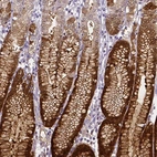 Anti-AKR1B10 Antibody