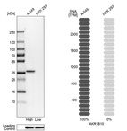 Western blot analysis in human cell lines A-549 and HEK293 using Anti-AKR1B10 antibody. Corresponding AKR1B10 RNA-seq data are presented for the same cell lines. Loading control: Anti-HSP90B1.