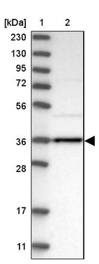 Lane 1: Marker [kDa] 230, 130, 95, 72, 56, 36, 28, 17, 11_br/_Lane 2: Human cell line RT-4