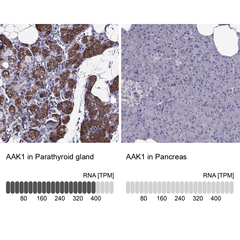 Anti-AAK1 Antibody