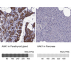 Anti-AAK1 Antibody