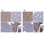 Immunohistochemical staining of human cerebral cortex, gastrointestinal, pancreas and parathyroid gland using Anti-AAK1 antibody HPA020289 (A) shows similar protein distribution across tissues to independent antibody HPA017931 (B).