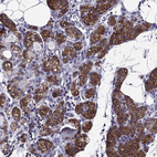 Immunohistochemical staining of human parathyroid gland shows strong membranous positivity in glandular cells.