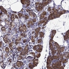 Immunohistochemical staining of human parathyroid gland shows strong membranous positivity in glandular cells.
