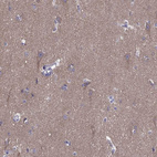 Immunohistochemical staining of human cerebral cortex shows moderate positivity in neuronal processes in neuropil.