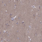 Immunohistochemical staining of human cerebral cortex shows moderate positivity in neuronal processes in neuropil.
