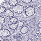 Immunohistochemical staining of human colon shows no positivity in glandular cells as expected.