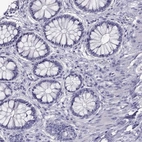 Immunohistochemical staining of human colon shows no positivity in glandular cells as expected.