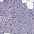 Immunohistochemical staining of human pancreas shows no positivity in exocrine glandular cells as expected.