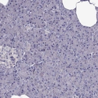 Immunohistochemical staining of human pancreas shows no positivity in exocrine glandular cells as expected.
