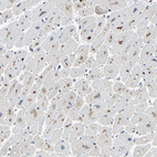 Immunohistochemical staining of human heart muscle shows strong granular cytoplasmic positivity in cardiomyocytes.