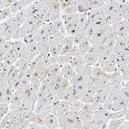Immunohistochemical staining of human heart muscle shows strong granular cytoplasmic positivity in cardiomyocytes.