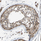 Immunohistochemical staining of human testis shows strong granular cytoplasmic positivity in cells in seminiferous ducts.
