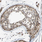 Immunohistochemical staining of human testis shows strong granular cytoplasmic positivity in cells in seminiferous ducts.