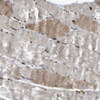 Immunohistochemical staining of human skeletal muscle shows strong granular cytoplasmic positivity in myocytes.