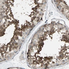 Immunohistochemical staining of human testis shows moderate cytoplasmic and membranous positivity in cells in seminiferous ducts.