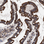 Immunohistochemical staining of human Duodenum shows strong granular cytoplasmic positivity in glandular cells.