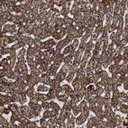 Immunohistochemical staining of human Liver shows strong granular cytoplasmic positivity in hepatocytes.