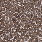 Immunohistochemical staining of human Liver shows strong granular cytoplasmic positivity in hepatocytes.
