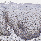 Immunohistochemical staining of human Cervix shows moderate granular cytoplasmic positivity in squamous epithelial cells.
