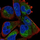 Immunofluorescent staining of human cell line RH-30 shows localization to vesicles.