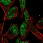 Immunofluorescent staining of human cell line RH-30 shows localization to nucleus.