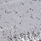 Immunohistochemical staining of human cerebellum shows strong nuclear positivity in cells in molecular layer.