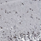 Immunohistochemical staining of human cerebellum shows strong nuclear positivity in cells in molecular layer.