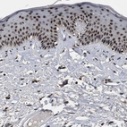 Immunohistochemical staining of human skin shows moderate to strong nuclear positivity in keratinocytes.