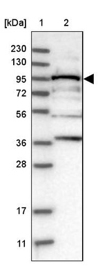 Lane 1: Marker [kDa] 230, 130, 95, 72, 56, 36, 28, 17, 11_br/_Lane 2: Human cell line RT-4