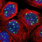 Immunofluorescent staining of human cell line A-431 shows localization to nucleoli.