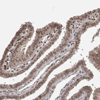 Anti-ZNF592 Antibody