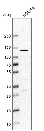 Anti-SMARCAL1 Antibody