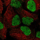 Immunofluorescent staining of human cell line HEK 293 shows localization to nucleoplasm.
