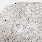 Immunohistochemical staining of human cervix, uterine shows moderate to strong nuclear positivity in squamous epithelial cells.