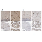 Immunohistochemical staining of human cerebellum, cerebral cortex, skeletal muscle and testis using Anti-ATXN2 antibody HPA020339 (A) shows similar protein distribution across tissues to independent antibody HPA018295 (B).