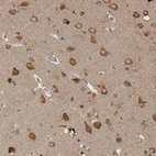 Immunohistochemical staining of human cerebral cortex shows moderate to strong cytoplasmic positivity in neurons.