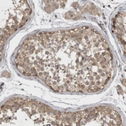 Immunohistochemical staining of human testis shows moderate cytoplasmic positivity in cells in seminiferous ducts.