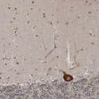 Immunohistochemical staining of human cerebellum shows strong cytoplasmic positivity in Purkinje cells.
