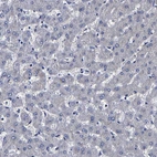 Immunohistochemical staining of human liver shows no positivity in hepatocytes as expected.