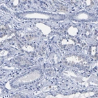 Immunohistochemical staining of human kidney shows no positivity in cells in tubules as expected.