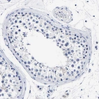 Immunohistochemical staining of human testis shows no positivity in cells in seminiferous ducts as expected.