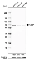 Western blot analysis in EFO-21 cells transfected with control siRNA, target specific siRNA probe #1 and #2, using Anti-CWC27 antibody. Remaining relative intensity is presented. Loading control: Anti-GAPDH.
