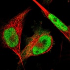 Immunofluorescent staining of human cell line U-251 MG shows localization to nucleoplasm.